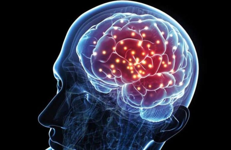 Alzheimer's Disease