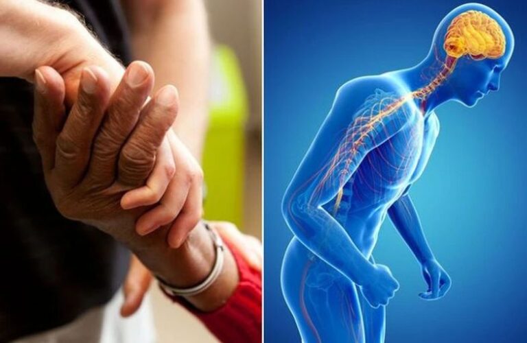 Parkinson’s Disease