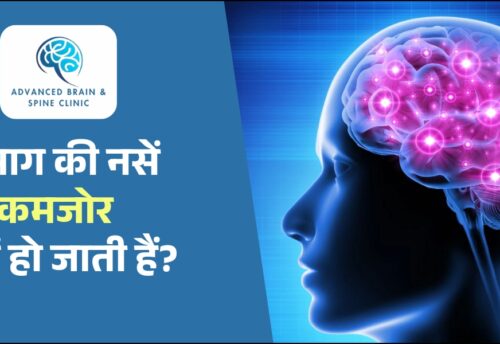 दिमाग की नसें कमजोर होना