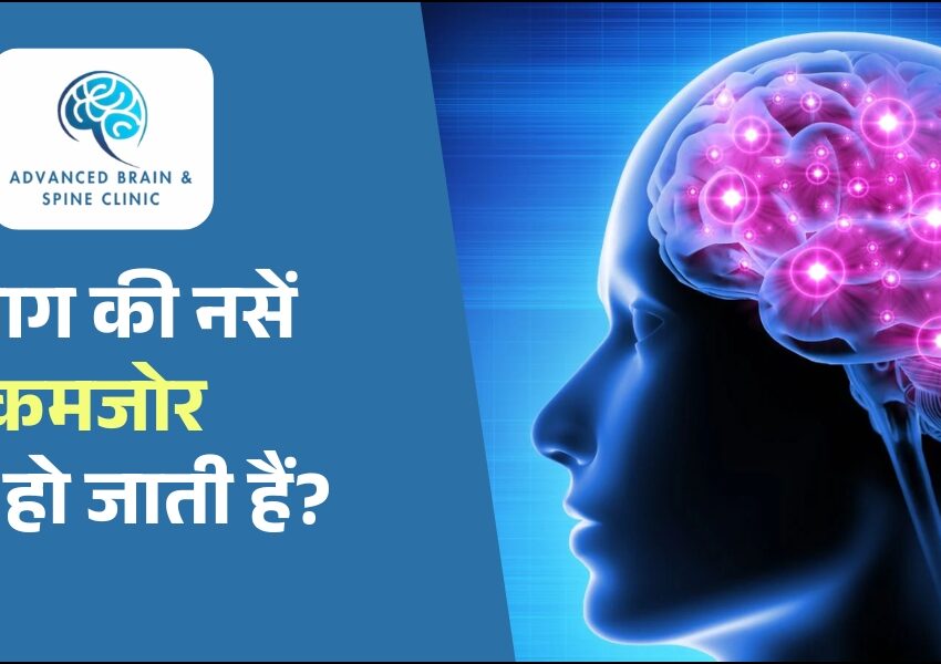 दिमाग की नसें कमजोर होना