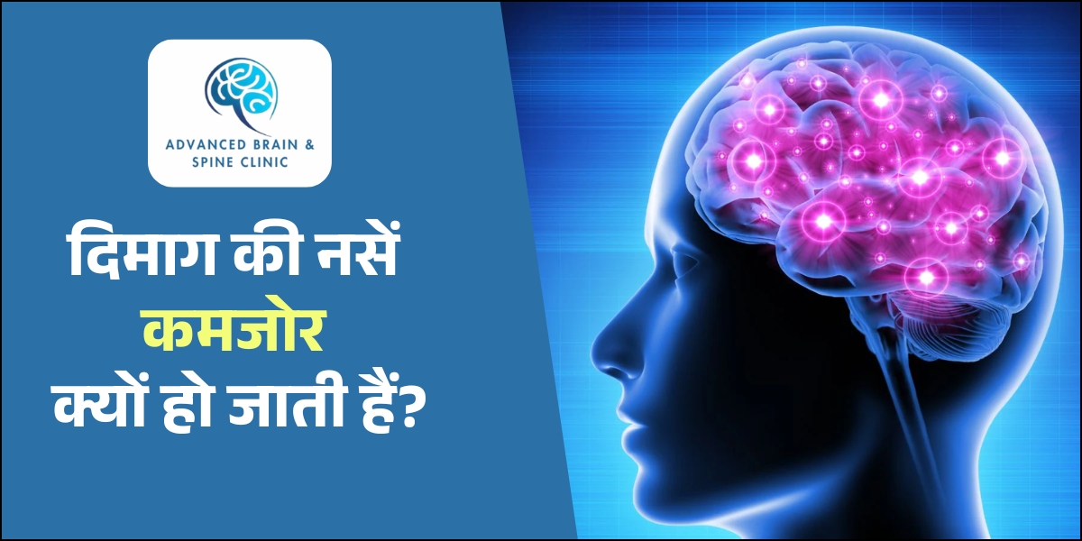दिमाग की नसें कमजोर होना
