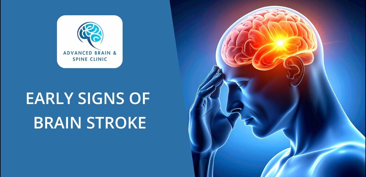 Brain Stroke Treatment