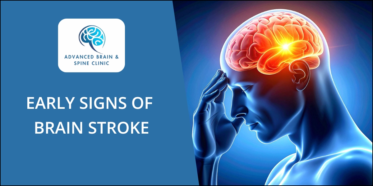 Brain Stroke Treatment