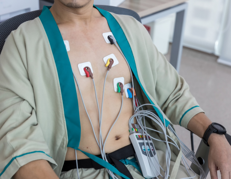 Holter Test (Holter Monitoring)