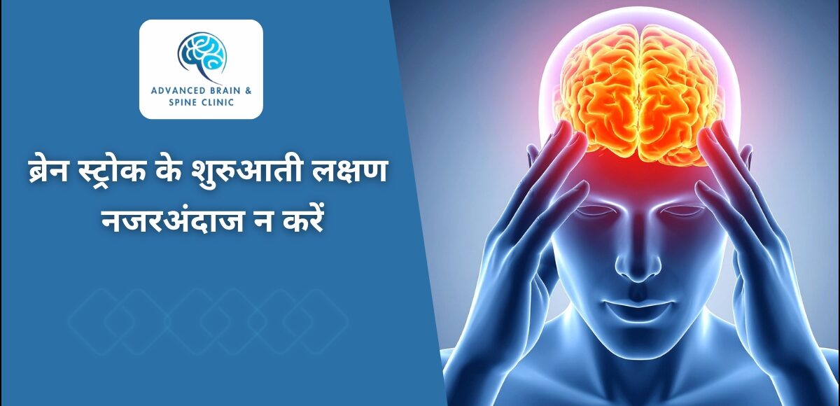 ब्रेन स्ट्रोक के शुरुआती लक्षण क्या हैं