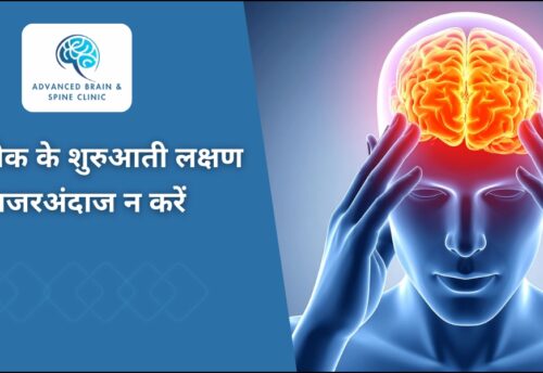 ब्रेन स्ट्रोक के शुरुआती लक्षण क्या हैं