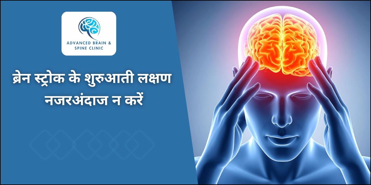 ब्रेन स्ट्रोक के शुरुआती लक्षण क्या हैं