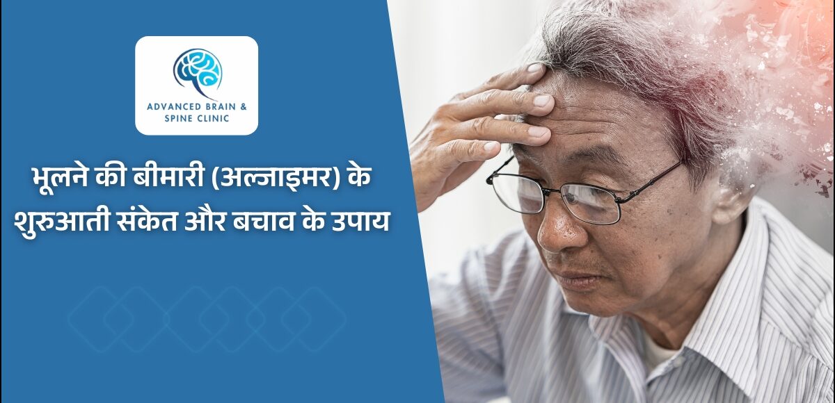 Alzheimer's Disease - भूलने की बीमारी